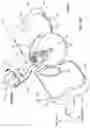 Fig. 02 - Catheter securement device including extended anchor pad and release liner clasping features