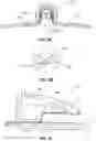Fig. 08 - Catheter securement device including extended anchor pad and release liner clasping features
