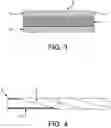 Fig. 03 - Non-shortening wrapped balloon