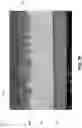 Fig. 16 - IMPLANTABLE ELECTRODES COMPRISING MECHANICALLY CONSTRAINED BIOCOMPATIBLE HYDROGELS WITH CONDUCTIVE PASSTHROUGH