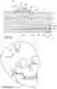 Fig. 05 - INTRACALVARIAL BCI SYSTEMS AND METHODS FOR THEIR MAKING, IMPLANTATION AND USE