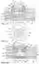 Fig. 06 - INTRACALVARIAL BCI SYSTEMS AND METHODS FOR THEIR MAKING, IMPLANTATION AND USE