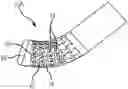 Fig. 01 - Flexible high-density mapping catheter tips and flexible ablation catheter tips with onboard high-density mapping electrodes