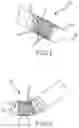 Fig. 02 - Flexible high-density mapping catheter tips and flexible ablation catheter tips with onboard high-density mapping electrodes
