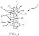 Fig. 03 - Flexible high-density mapping catheter tips and flexible ablation catheter tips with onboard high-density mapping electrodes