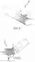 Fig. 04 - Flexible high-density mapping catheter tips and flexible ablation catheter tips with onboard high-density mapping electrodes