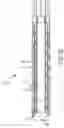 Fig. 10 - Flexible high-density mapping catheter tips and flexible ablation catheter tips with onboard high-density mapping electrodes