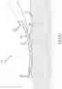 Fig. 23 - Flexible high-density mapping catheter tips and flexible ablation catheter tips with onboard high-density mapping electrodes