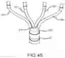 Fig. 28 - Flexible high-density mapping catheter tips and flexible ablation catheter tips with onboard high-density mapping electrodes