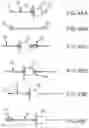 Fig. 31 - Flexible high-density mapping catheter tips and flexible ablation catheter tips with onboard high-density mapping electrodes