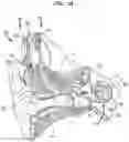 Fig. 02 - Electro-acoustic interaction control in auditory prostheses