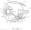 Fig. 05 - METHOD AND DEVICE FOR ELECTROLYSIS OF AQUEOUS HUMOR TO TREAT GLAUCOMA
