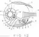 Fig. 07 - METHOD AND DEVICE FOR ELECTROLYSIS OF AQUEOUS HUMOR TO TREAT GLAUCOMA
