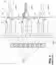 Fig. 02 - Methods of implanting a stimulation lead for stimulation of a dorsal root ganglion