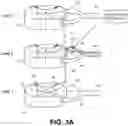 Fig. 04 - Methods of implanting a stimulation lead for stimulation of a dorsal root ganglion