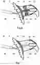 Fig. 05 - Method and apparatus for recovering and stabilizing normal heart rate of patients suffering in or being inclined to having atrial fibrillation