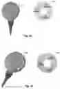 Fig. 04 - Inductive link coupling based on relative angular position determination for medical implant systems