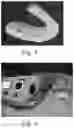 Fig. 03 - Semisolid oral dispersions comprising bleaching agents