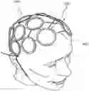 Fig. 01 - Apparatus and Method for Indicating Treatment Site Locations for Phototherapy to the Brain