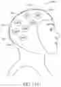 Fig. 28 - Apparatus and Method for Indicating Treatment Site Locations for Phototherapy to the Brain