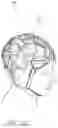 Fig. 36 - Apparatus and Method for Indicating Treatment Site Locations for Phototherapy to the Brain