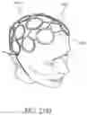 Fig. 39 - Apparatus and Method for Indicating Treatment Site Locations for Phototherapy to the Brain
