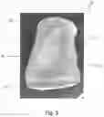 Fig. 04 - Portable containment device