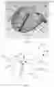 Fig. 05 - Golf club having an adjustable weight assembly