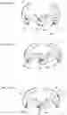 Fig. 08 - FORM CHANGING TOY