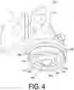 Fig. 05 - Filtration device