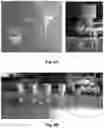 Fig. 09 - Method and device for separating extracellular vesicles from biological liquids with the aid of cascade ultrafiltration