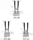 Fig. 12 - Pipette tip for and method of automatically maintaining pipette tip depth in a fluid