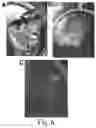 Fig. 07 - Hydrogel membrane and methods for selective retrieval of microbial targets