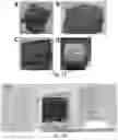 Fig. 15 - Hydrogel membrane and methods for selective retrieval of microbial targets