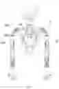 Fig. 03 - Robot