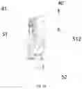 Fig. 15 - Robot