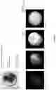 Fig. 07 - A MICROCAPSULE FOR DETECTING AND/OR QUANTITATING AN ANALYTE IN A SAMPLE