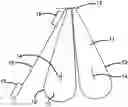Fig. 01 - Method and apparatus for introducing a cable into a conduit