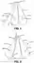 Fig. 02 - Method and apparatus for introducing a cable into a conduit