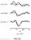 Fig. 10 - Brain-computer interface with adaptations for high-speed, accurate, and intuitive user interactions