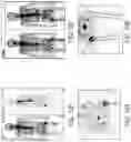 Fig. 14 - Systems and methods for automated and interactive analysis of bone scan images for detection of metastases