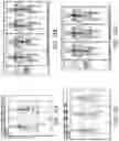 Fig. 15 - Systems and methods for automated and interactive analysis of bone scan images for detection of metastases