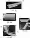 Fig. 08 - Automatic suture device to reduce bleeding in gastric bypass surgery