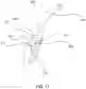 Fig. 11 - Implant positioner and sternal plating system