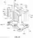 Fig. 31 - Implant positioner and sternal plating system