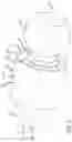 Fig. 04 - Thread form for bone screw