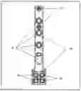 Fig. 02 - Method for treating and repairing knee fractures resulting from benign tumors using patient-specific electronic templates