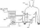 Fig. 01 - Testing tissue viability for an anastomosis