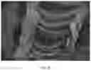 Fig. 09 - Composite scaffold for the repair, reconstruction, and regeneration of soft tissues