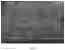 Fig. 15 - Composite scaffold for the repair, reconstruction, and regeneration of soft tissues